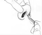 cartilage-splitting 10