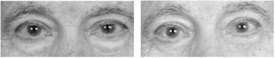 Rhinoplasty and Sinus Surgery