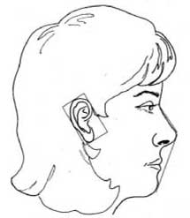 Figure 17