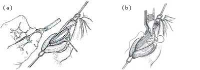Figure 21