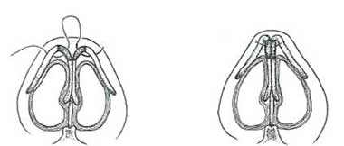 Figure 30