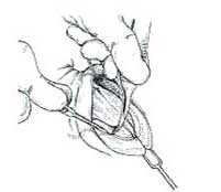 Figure 32