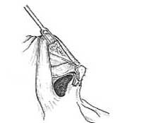 Figure 33