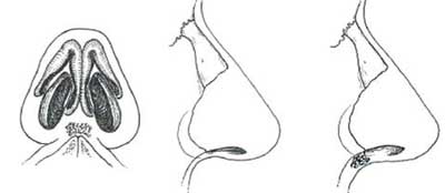 Figure 34