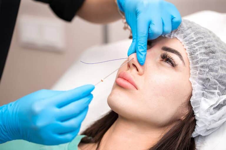 3 Best Alternatives for Rhinoplasty Less Invasive Options