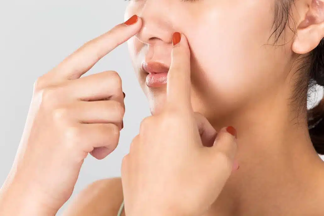 Thick skin rhinoplasty recovery typically takes longer than for patients with thinner skin, as the thicker subcutaneous fatty layer can affect swelling after surgery
