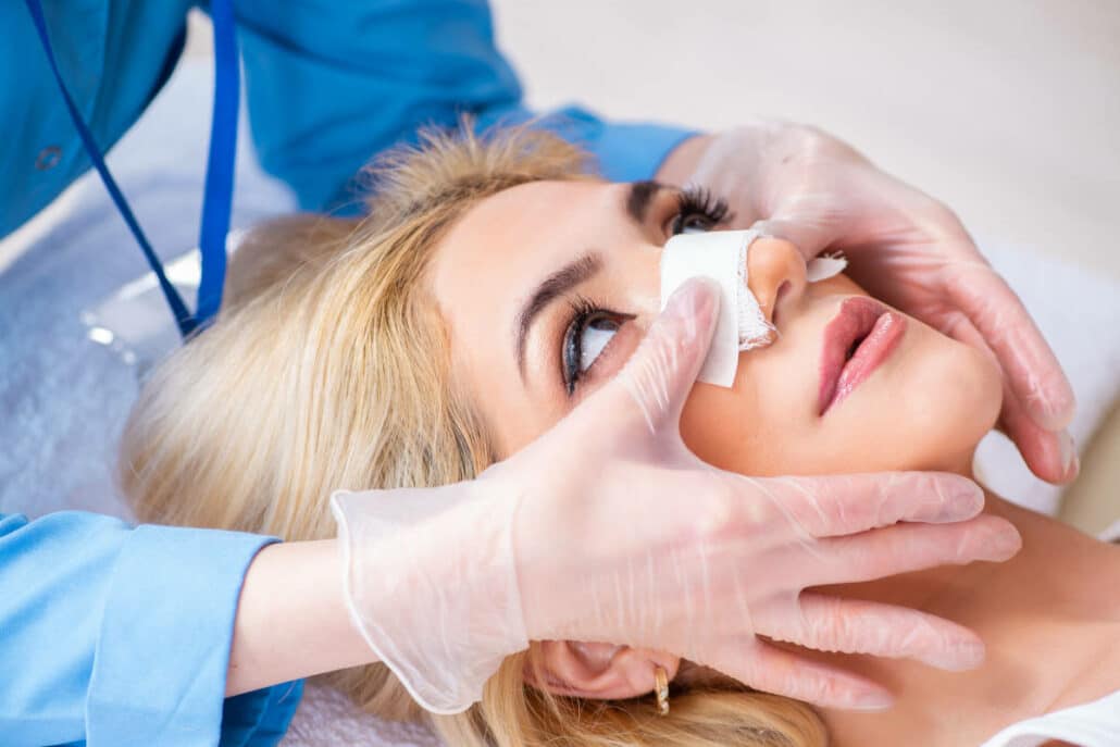 Rhinoplasty is classified as open or closed, depending on the incision type.