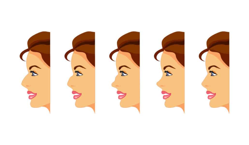 An average-sized nose is proportional to the rest of the facial features.