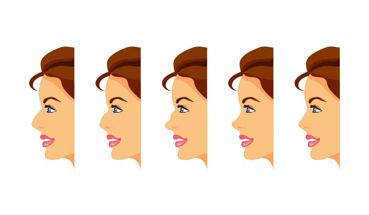 Discover the different types of noses and how rhinoplasty can enhance each unique shape.