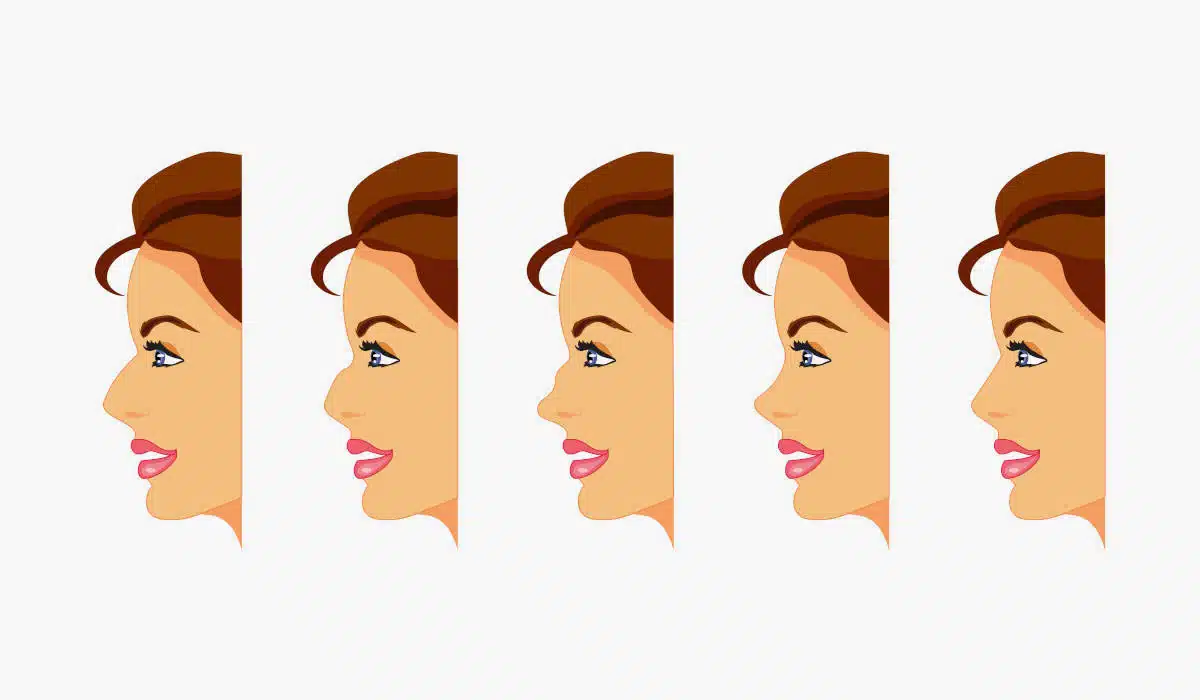 Discover the different types of noses and how rhinoplasty can enhance each unique shape.