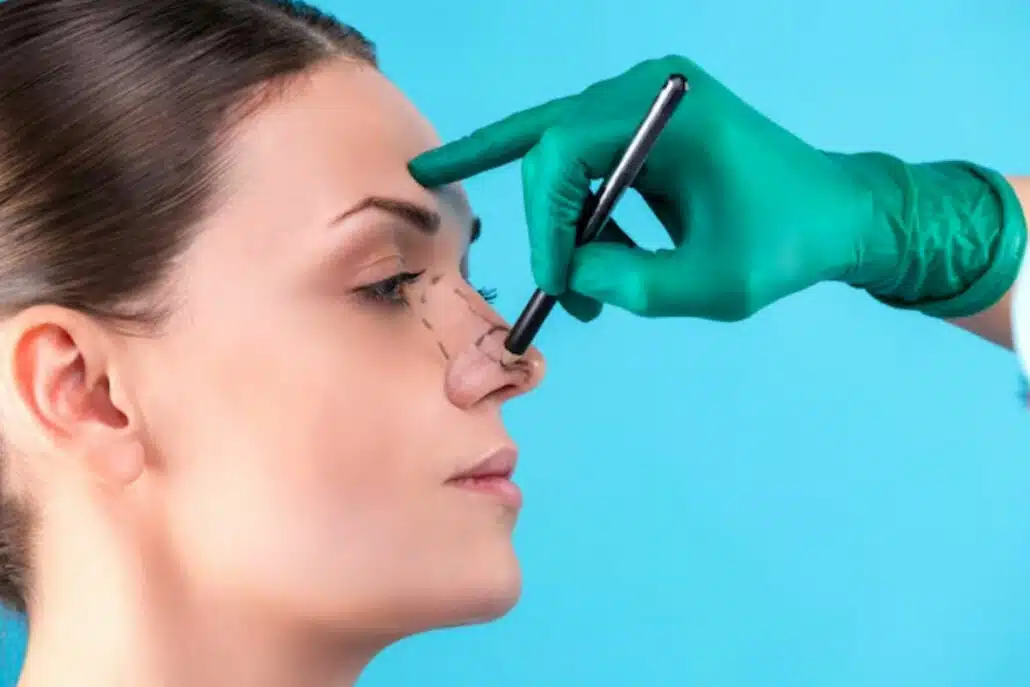 a person contemplating rhinoplasty surgery