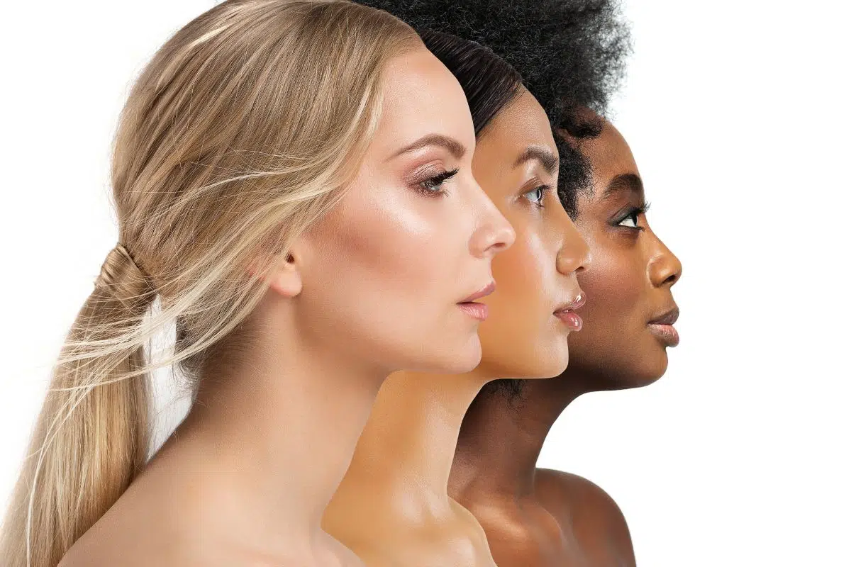 Side profiles of diverse women highlighting nasal differences for ethnic vs standard rhinoplasty comparison.