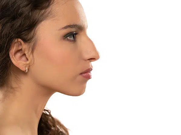Woman in profile highlighting nose size and shape considerations for rhinoplasty and balanced facial aesthetics.